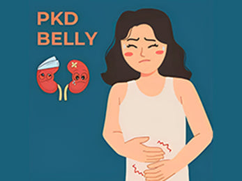 What is PKD Belly?