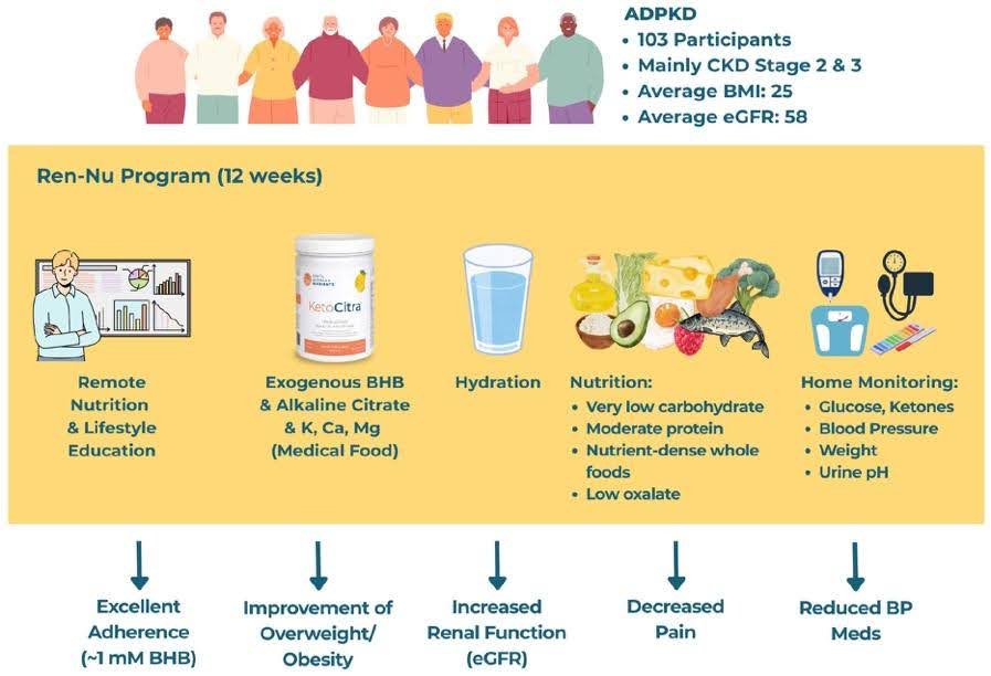 Santa Barbara Nutrients Announces Publication of Peer-Reviewed Study Reporting Real-World Outcomes of Ren-Nu™ Program for Polycystic Kidney Disease
